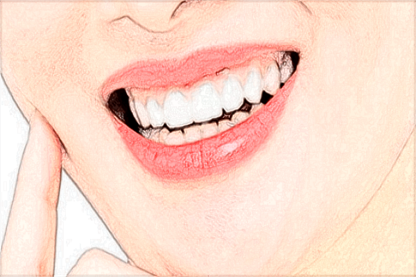 2024北京麗都種植牙價(jià)格表_種植牙的后遺癥有哪些