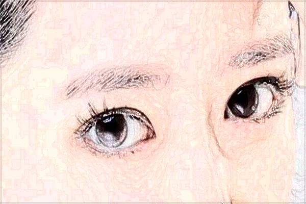 北京天壇醫(yī)院割雙眼皮怎么樣_哪位醫(yī)生做的比較好