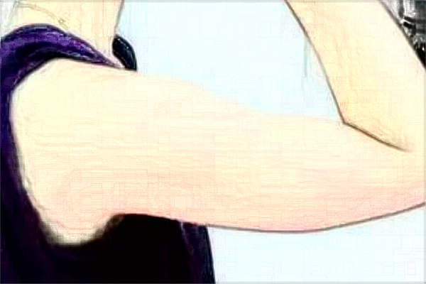 2024廣州華美去腋臭怎么樣_去腋臭會復(fù)發(fā)嗎