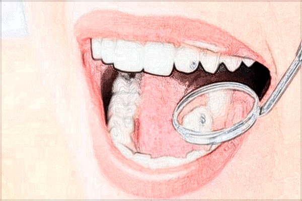 2024重慶解放軍324醫(yī)院口腔科前牙種植好不好_哪位醫(yī)生做的比較好