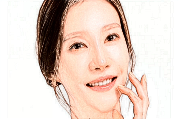 上海時光整形醫(yī)院去紅血絲怎么樣【附激光去紅血絲案例】