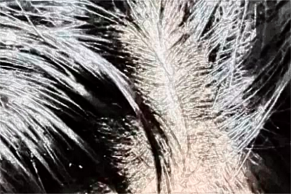 上海植發(fā)醫(yī)院哪家技術好_植發(fā)多少錢