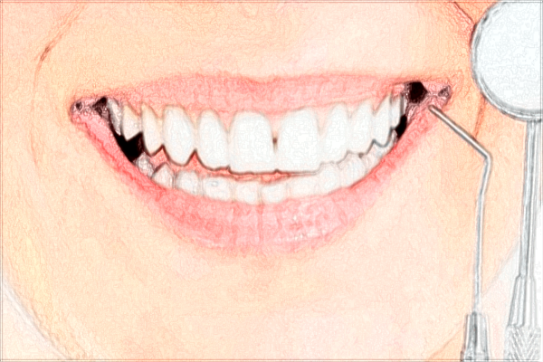 蕪湖市第二人民醫(yī)院怎么樣?2024牙齒矯正價格