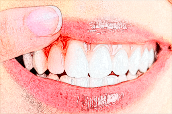 北大醫(yī)院口腔科牙齒美白價目表(價格表)怎么樣