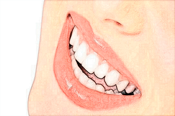 北大醫(yī)院口腔科牙齒美白價目表(價格表)怎么樣