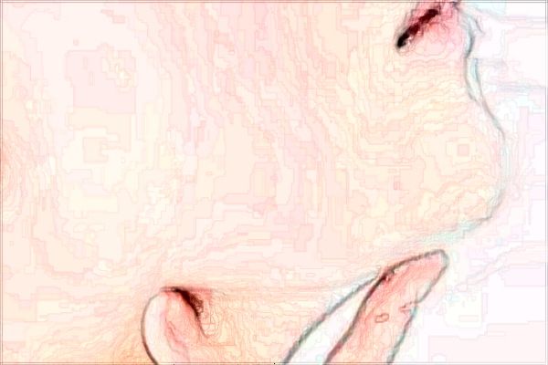 北京潤(rùn)美玉之光去雙下巴哪個(gè)醫(yī)生好_怎么樣