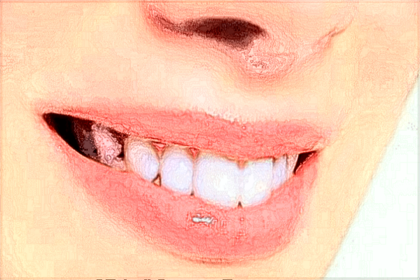 常熟二院牙齒矯正醫(yī)生技術(shù)好嗎?醫(yī)生收費(fèi)價(jià)格2024