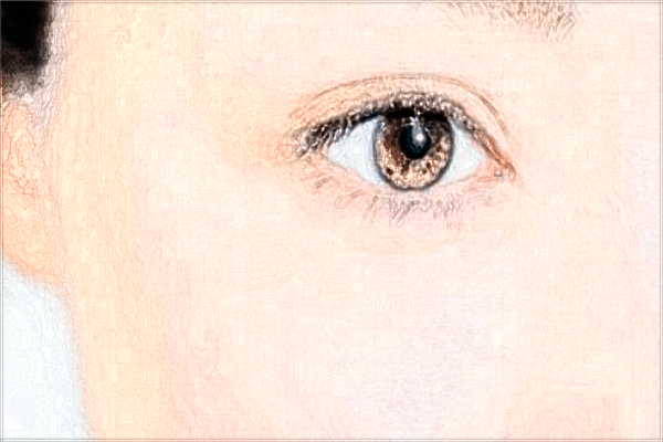 淮安二院光子嫩膚醫(yī)生技術(shù)好不好?收費價格2024