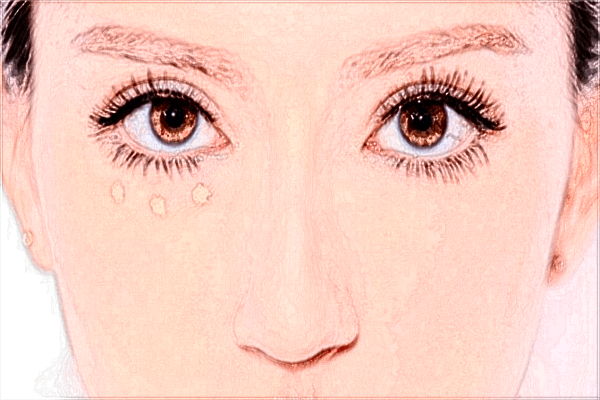 聊城二院隆鼻需要多少錢?隆鼻后多久恢復(fù)自然?