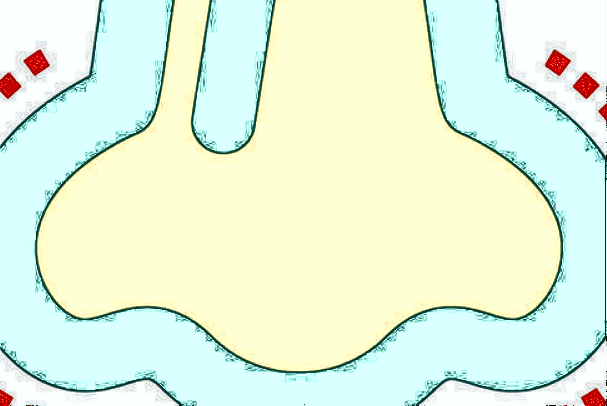 膨體隆鼻會(huì)變細(xì)變窄嗎?膨體隆鼻會(huì)回縮多少呢?