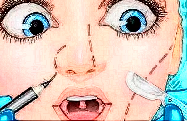 膨體隆鼻需要麻醉嗎?膨體隆鼻需要全麻嗎?