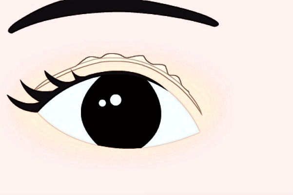 2024做臥蠶收費(fèi)價格多少_西安二院做臥蠶怎么樣