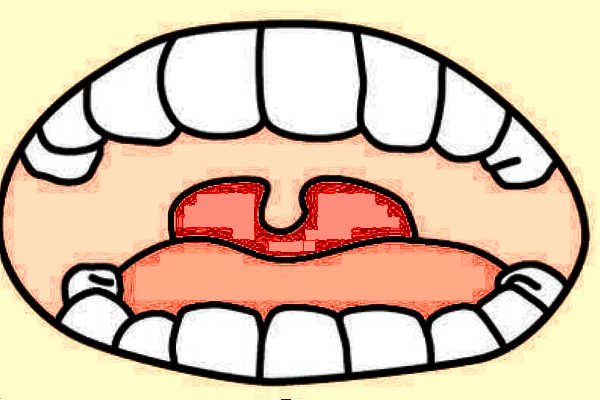 2024河北省口腔醫(yī)院牙齒矯正價(jià)格表_做的怎么樣