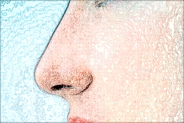 四川省人民醫(yī)院去胎記價(jià)目表(價(jià)格表)怎么樣