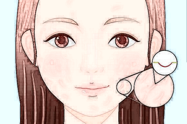 寧波二院去疤痕怎么樣?寧波二院去疤痕收費標準