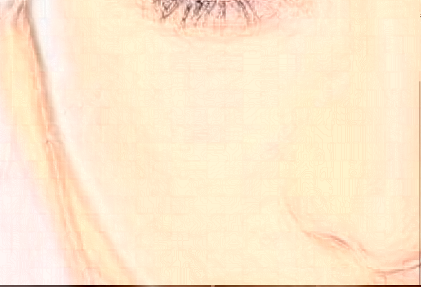 上海華山醫(yī)院脂肪填充需要多少費用_做的好的醫(yī)生有哪些