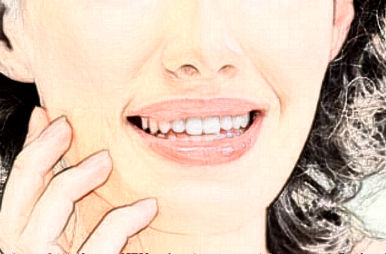 四川省人民醫(yī)院激光美容怎么樣_哪些醫(yī)生技術(shù)比較好