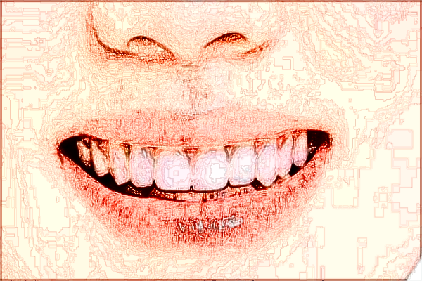 2024四川省人民醫(yī)院隱形矯正牙齒費用_醫(yī)生名單