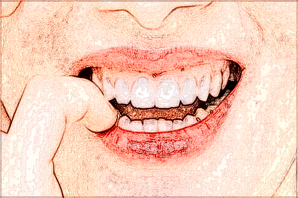 2024四川省人民醫(yī)院隱形矯正牙齒費用_醫(yī)生名單