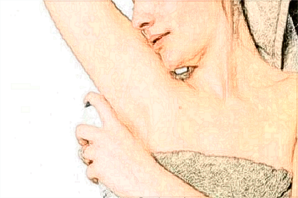 2024四川省人民醫(yī)院微創(chuàng)狐臭要多少錢(qián)【做狐臭案例】