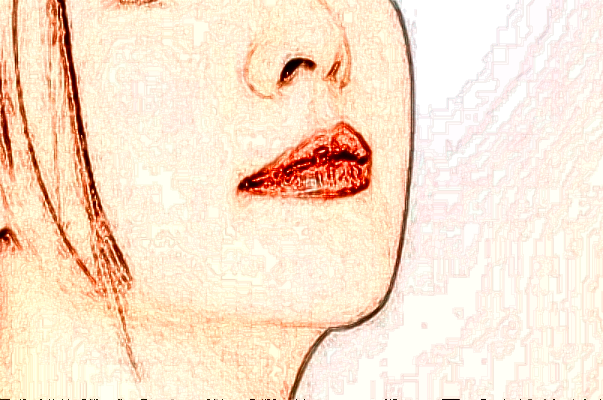 南京市中醫(yī)院光子嫩膚多少錢【光子嫩膚案例】