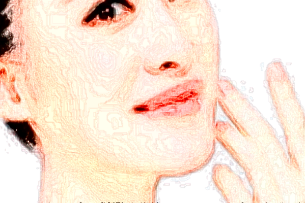 南京市中醫(yī)院光子嫩膚多少錢【光子嫩膚案例】