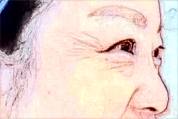 2024威海市立二院自體脂肪填充面部價格怎么樣