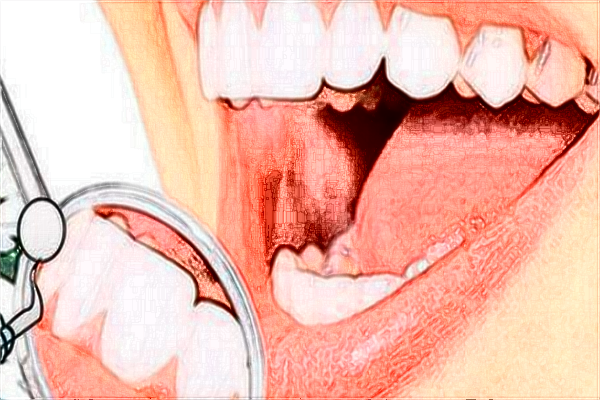 2024福建醫(yī)科大學(xué)附屬協(xié)和醫(yī)院牙齒矯正多少錢(qián)
