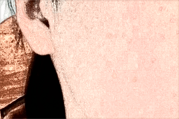 2024泰安市中醫(yī)二院光子嫩膚多少錢_光子嫩膚的副作用