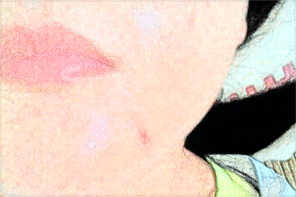 自體脂肪豐面頰多少錢(qián)?自體脂肪豐面頰多久可以做第二次?