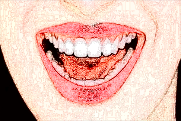 2024淮北市人民醫(yī)院口腔科專家名單介紹【種植牙案例】