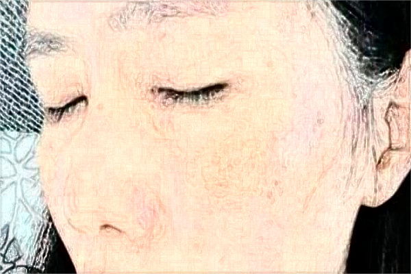 贛南醫(yī)學(xué)院第一附屬醫(yī)院祛痘印怎么樣?激光祛痘印價格2024