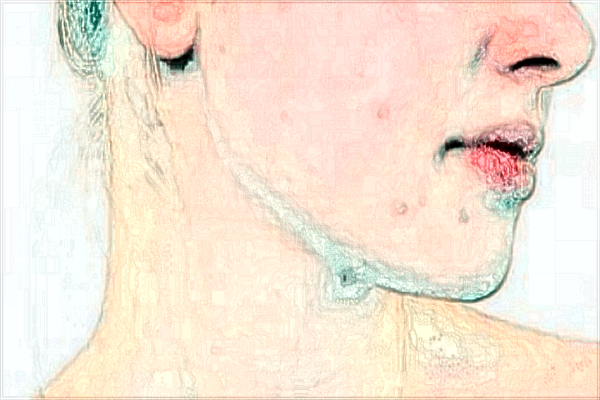 贛南醫(yī)學(xué)院第一附屬醫(yī)院光子嫩膚多少錢2024?光子嫩膚好嗎