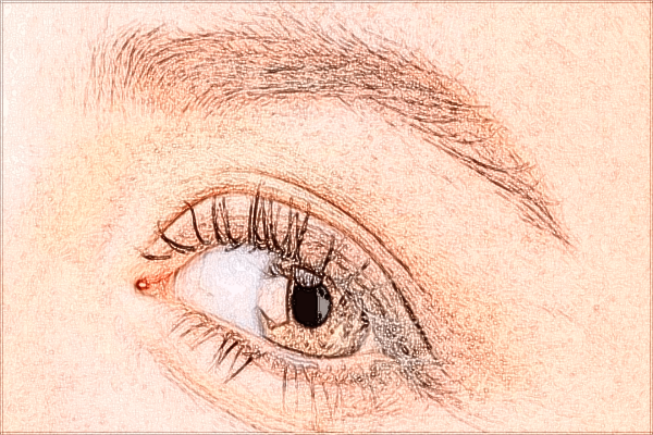 北京大學(xué)第一醫(yī)院激光點痣做的好嗎_哪位醫(yī)生做的比較好