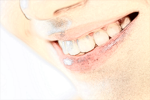 2024-2024淮北市人民醫(yī)院牙齒矯正價(jià)格【牙齒矯正案例】