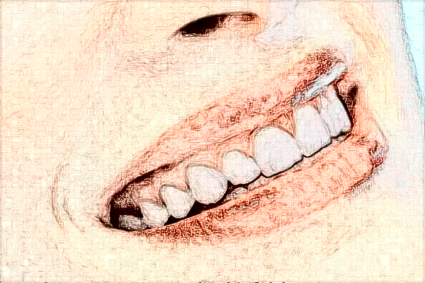 2024六安市人民醫(yī)院口腔科怎么樣_價格貴不貴