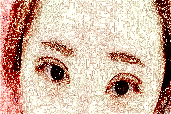 2024上海曙光醫(yī)院去眼袋怎么樣_技術好的醫(yī)生有哪些