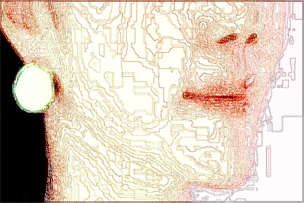 上海曙光醫(yī)院激光祛斑價目表(價格表)怎么樣