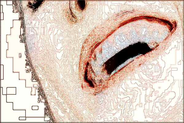 河北省口腔醫(yī)院全瓷貼面怎么樣_全瓷貼面對牙齒傷害大嗎