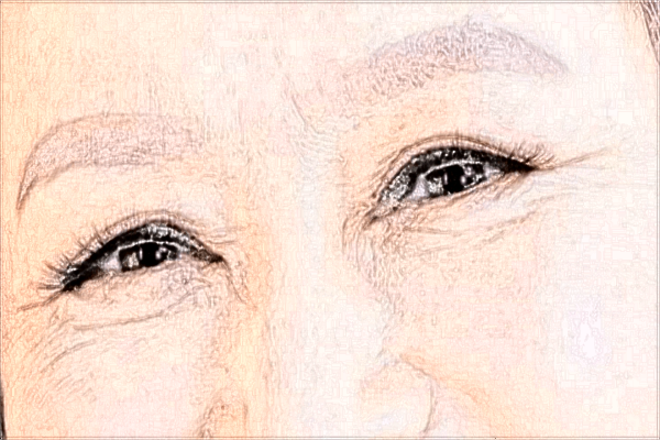 2024河科大二附院光子嫩膚價格表(價目表)怎么樣?