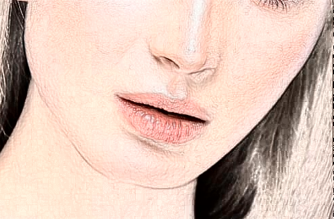 北京大學(xué)第一醫(yī)院熱拉提做的好嗎【熱拉提案例】