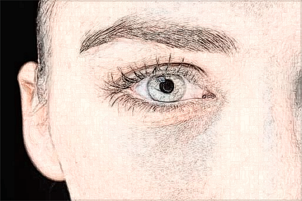 四川華西醫(yī)院祛疤怎么樣_案例分享