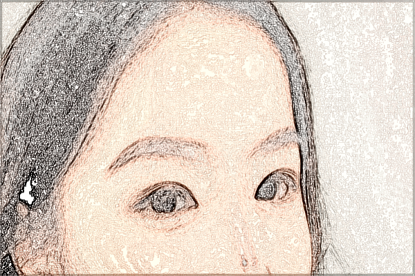 四川華西醫(yī)院去痣價(jià)目表(價(jià)格表)怎么樣