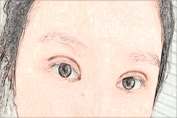 2024四川華西醫(yī)院熱瑪吉價(jià)目表(價(jià)格表)怎么樣