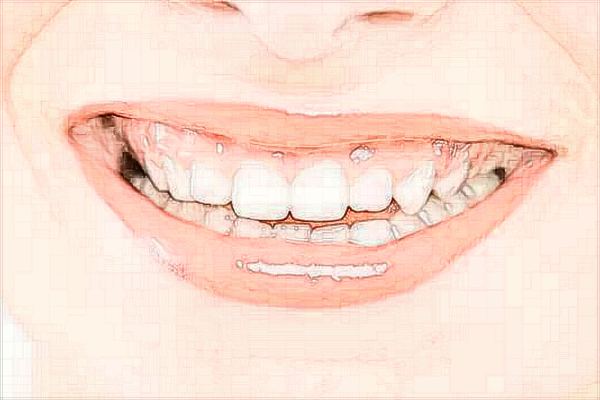 寧波市第一醫(yī)院牙齒矯正怎么樣、醫(yī)生做的好不好?