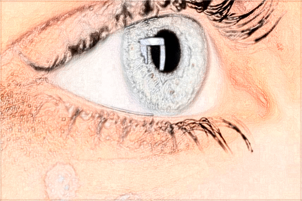 河科大二附院去眼袋技術怎么樣?2024去眼袋手術價格