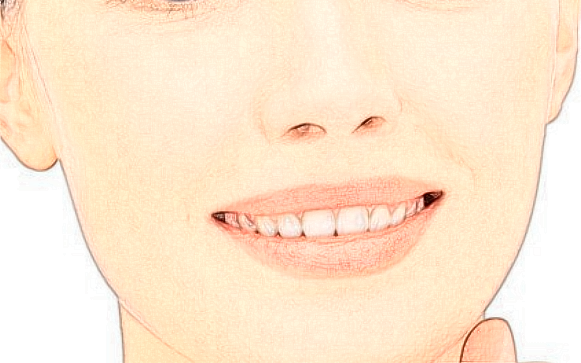 2024上海同濟(jì)醫(yī)院激光脫毛價格多少【激光脫毛案例】