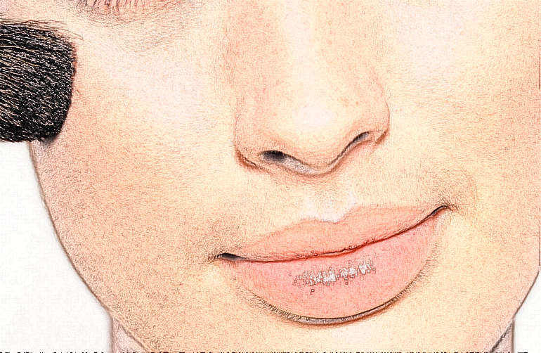 2024上海同濟(jì)醫(yī)院激光脫毛價格多少【激光脫毛案例】