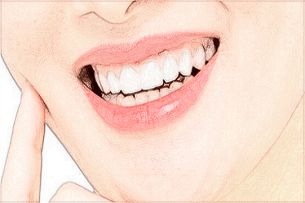 溫州醫(yī)學(xué)院附屬第一醫(yī)院種植半口牙怎么樣_案例+價(jià)格