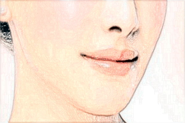 西安二院填淚溝多少錢?2024西安二院填淚溝收費價格